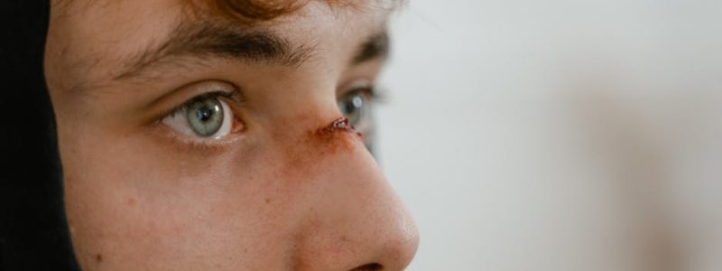 蒜頭鼻改善的專業知識分享